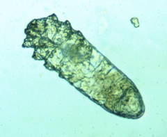 Demodecidae
