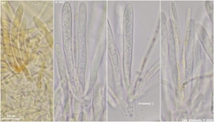 Lachnellula subtilissima