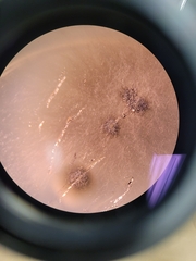Aureobasidium