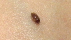 Lasioderma serricorne