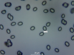 Cuphophyllus colemannianus