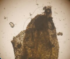 Solenostoma gracillimum