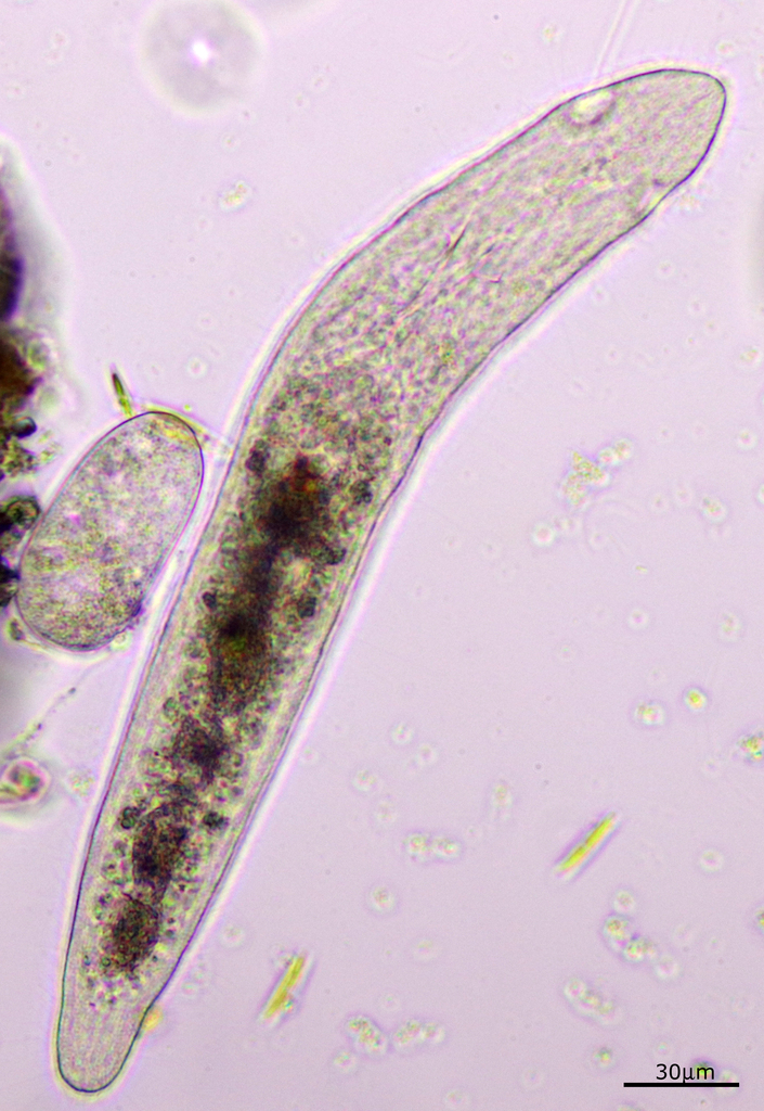 Stenostomum saliens