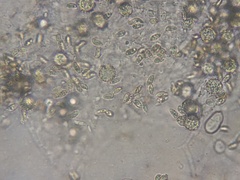 Hypomyces microspermus