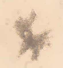 Amoebidae