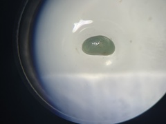 Ostracoda