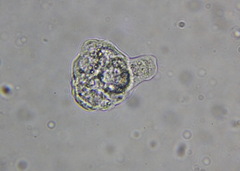 Amoebozoa