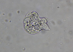 Amoebozoa