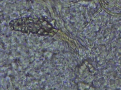 Steccherinum subcrinale