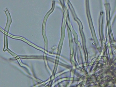 Steccherinum subcrinale