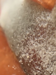 Botrytis