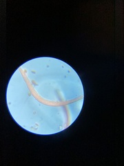 Spirostomum