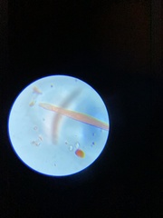 Spirostomum