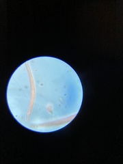 Spirostomum