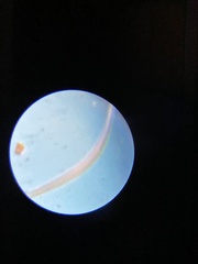 Spirostomum