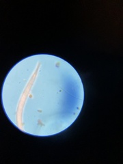 Spirostomum