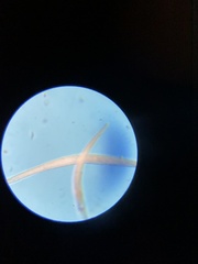 Spirostomum