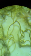 Hemitrichia calyculata