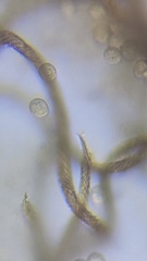 Hemitrichia calyculata