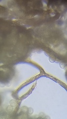 Hemitrichia calyculata