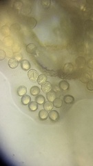 Hemitrichia calyculata