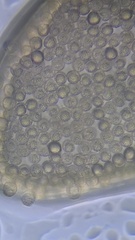 Hemitrichia calyculata