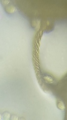 Hemitrichia calyculata