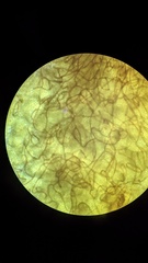 Hemitrichia calyculata