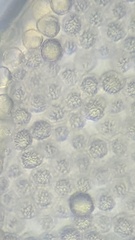 Hemitrichia calyculata