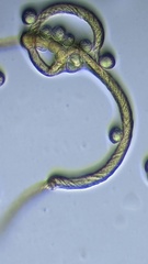 Hemitrichia calyculata