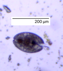 Ostracoda
