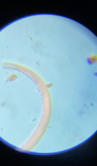 Spirostomum