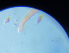 Spirostomum