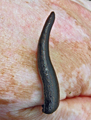 Hirudo medicinalis