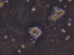 Amoebozoa