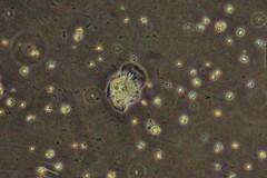 Amoebozoa