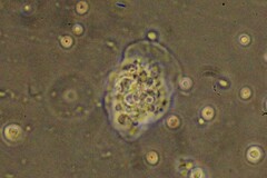 Amoebozoa