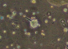 Amoebozoa