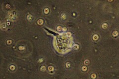 Amoebozoa
