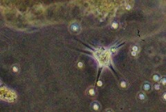 Amoebozoa