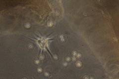 Amoebozoa