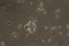 Amoebozoa
