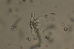 Amoebozoa