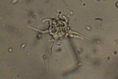 Amoebozoa
