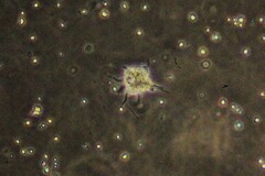 Amoebozoa