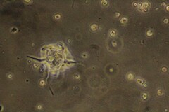 Amoebozoa