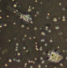 Amoebozoa