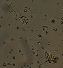 Amoebozoa