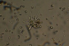 Amoebozoa