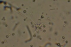 Amoebozoa